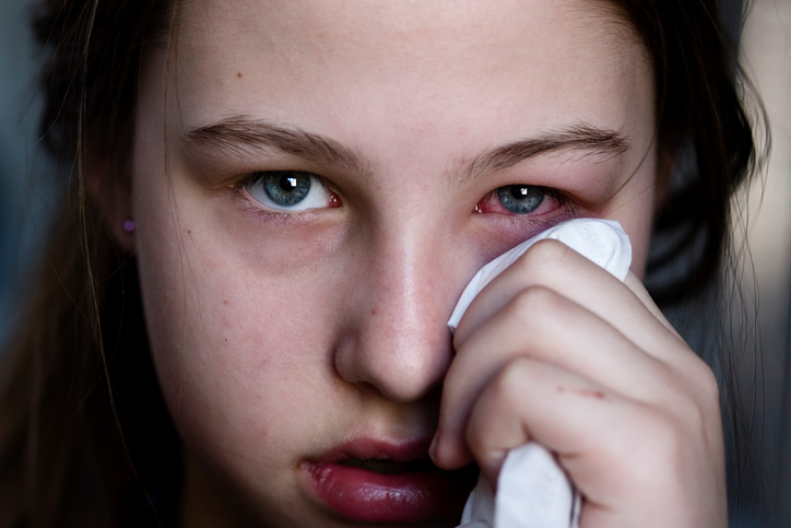 L'œil de la fillette est gonflé et douloureux, il s'agit peut-être d'une allergie.